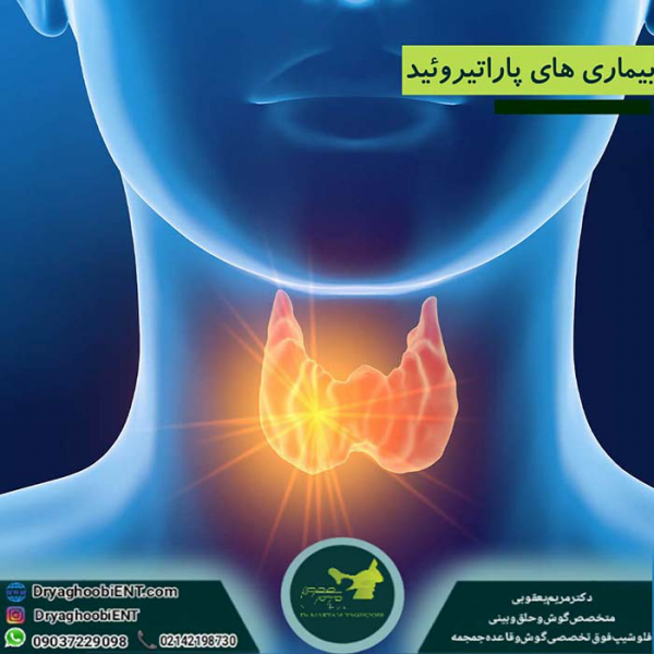 کم کاری پاراتیروئید
