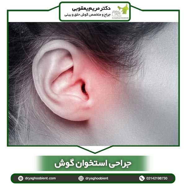 جراحی استخوان گوش