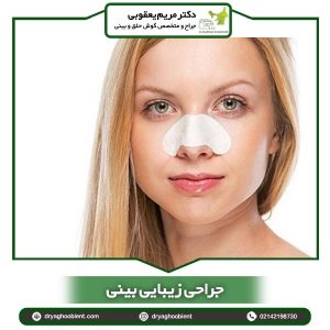 جراحی زیبایی بینی-دکتر یعقوبی