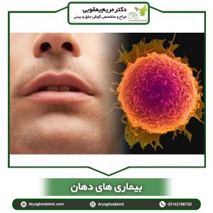 بیماری های دهان