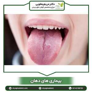 بیماری های دهان