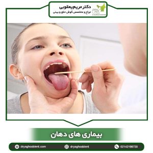 بیماری های دهان