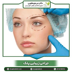 جراحی زیبایی پلک- دکتر یعقوبی
