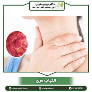 التهاب مری _ دکتر یعقوبی