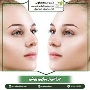 جراحی زیبایی بینی در تهران