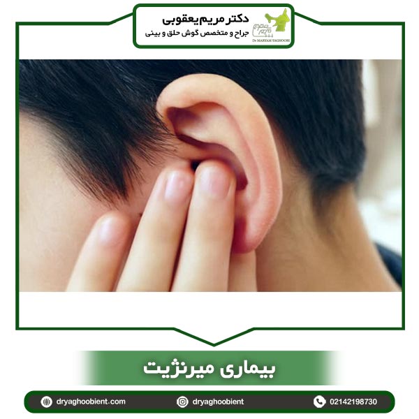 بیماری میرنژیت _ دکتر یعقوبی