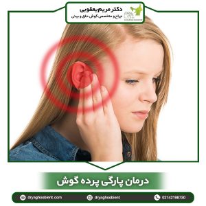 درمان پارگی پرده گوش _ دکتر یعقوبی