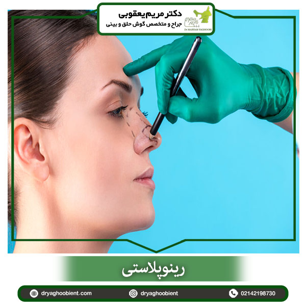 رینوپلاستی - دکتر مریم یعقوبی