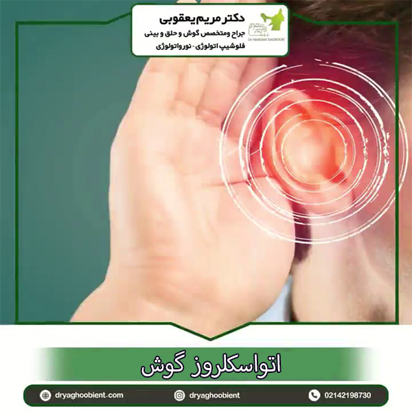 اتواسکلروز - دکتر یعقوبی