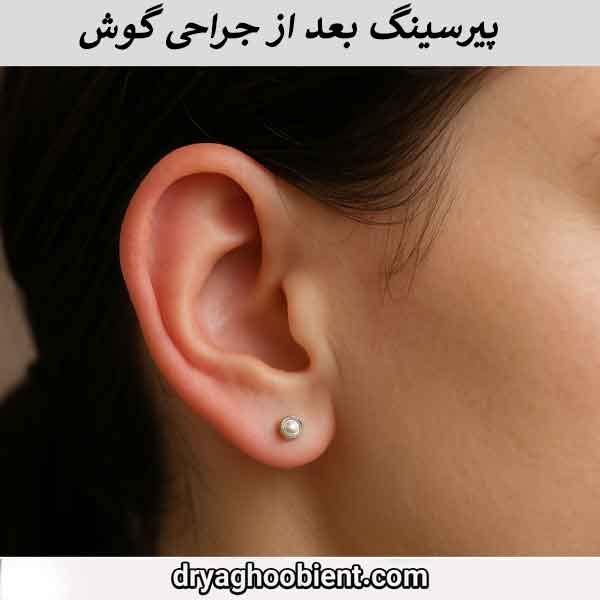 پیرسینگ بعد از عمل گوش